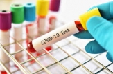 Persoanele cu forme ușoare ale infecției COVID-19 sunt testate la domiciliu