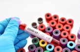 Bilanțul persoanelor infectate cu noul Coronavirus a ajuns la 63 275 cazuri