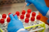 Alte 100 000 de teste pentru depistarea SARS-COV-2 au fost procurate și livrate Agenției Naționale pentru Sănătate Publică