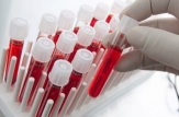 În Republica Moldova a fost lansat studiul de supraveghere serologică care va stabili nivelul seroprevalenței anticorpilor COVID-19 și hepatitelor virale